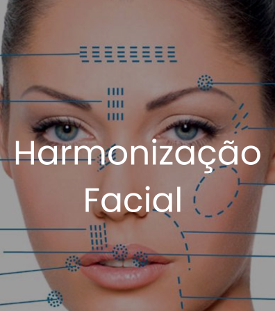 Harmonização Facial