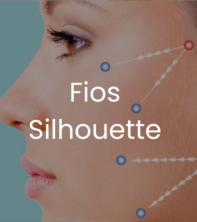 Fios Silhouette